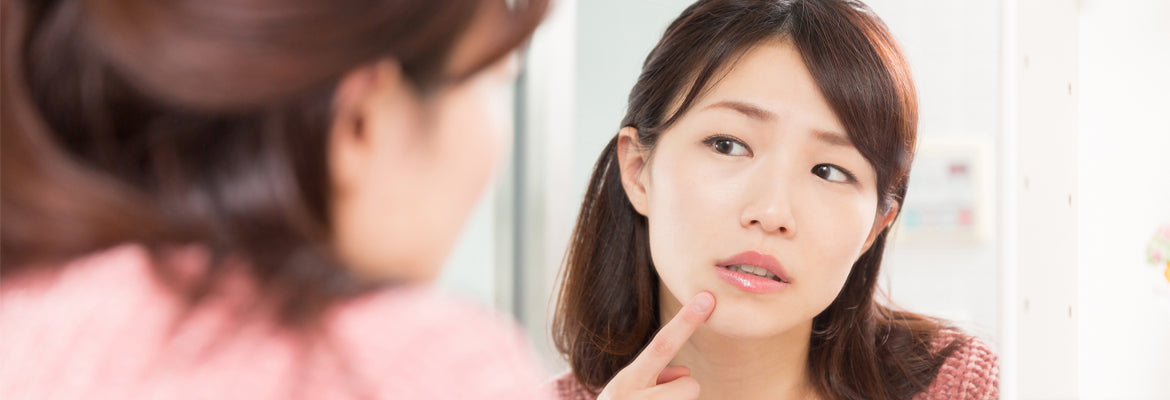 Acne: Myths and Facts